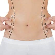liposuction naperville, il dr hein